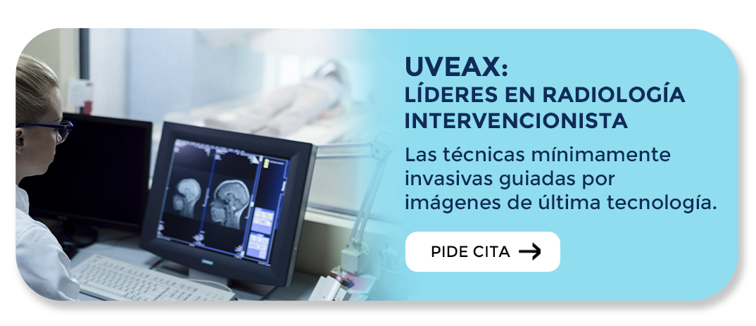 Radiología intervencionista