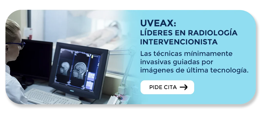 Radiología intervencionalista en Valencia